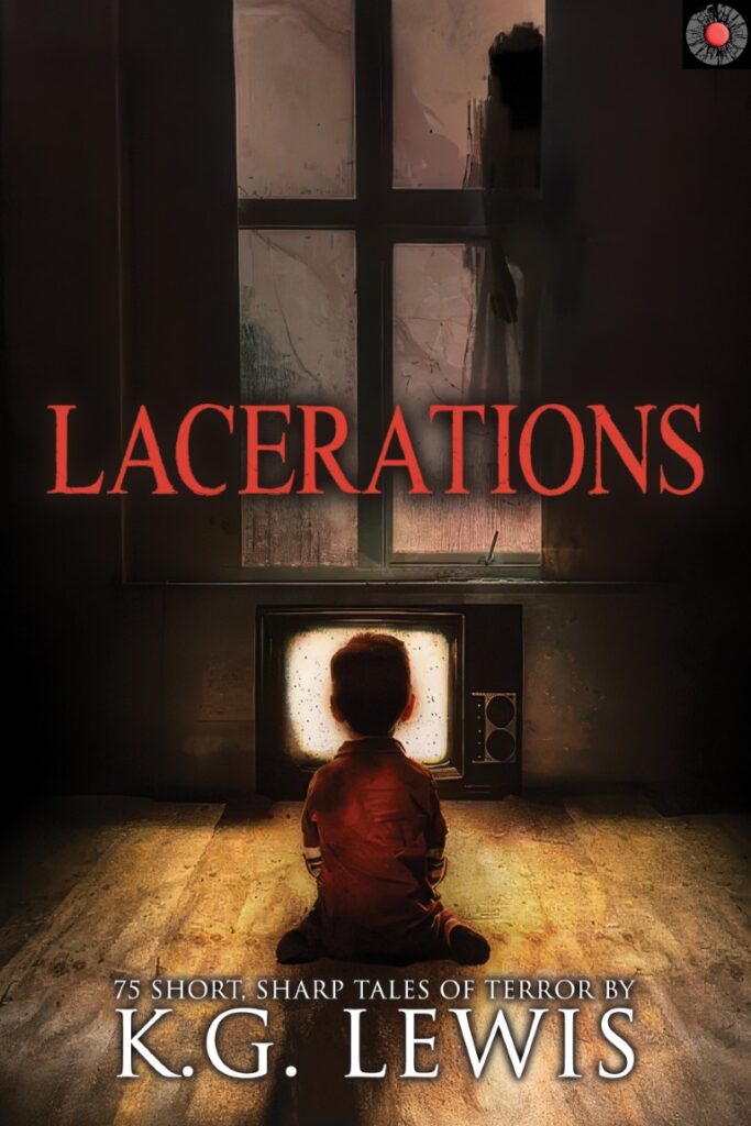 Lacerations
